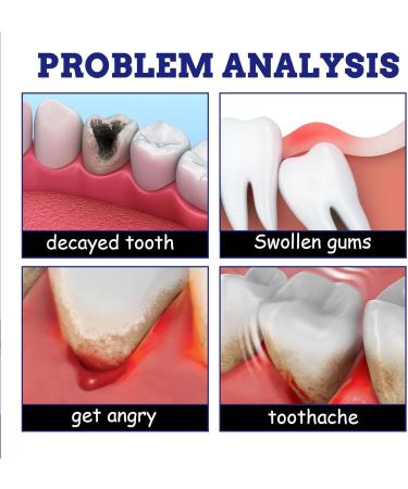 Koahde Toothache Spray - Herbal Oral Care for Instant Relief | Gum & Tissue Repair - Buy Online on GoSupps.com