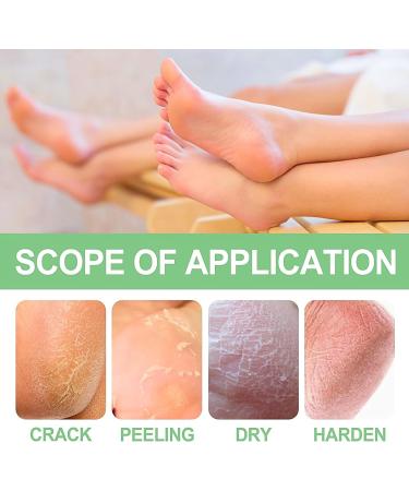 Trendyfave Foot Care Cream Foot Cream For Cracked Heels And Dry Skin Cracked Heel Repair Cream With Vitamin C And Aloe Vera For Deep Moisturizing Callus Remover And Soften Skin Care Hands & Feet - Buy Online on GoSupps.com