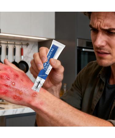 Scars Burns Cream - 30g Moisturizing Product for Scratching Marks - Reducing Cream for Old Scars - For Recovery of Cheloid Wounds Women Men Athletes - Buy Online on GoSupps.com