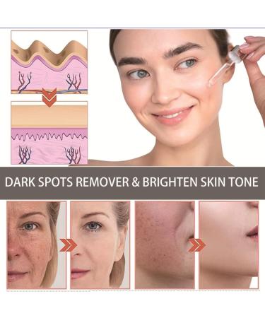 Retinol 1% in Squalane 30ml Retinol Serum for Face/Neck/Eyes Anti Aging Facial Serum for Moisturizing Retinol Face Serum High-Strength Face Serum for Activate Skin Reduce Fine Lines Wrinkles Skincare - Buy Online on GoSupps.com