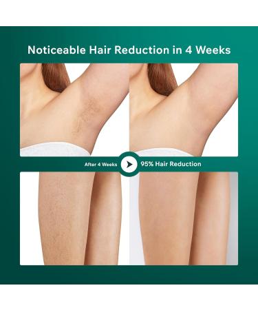 AMINZER 2023 IPL Hair Removal Device 3-in-1 Functions HR/SC/RA | 9 Energy Levels | 999900 Flashes | Painless Laser Hair Removal Device with LCD Touch Screen - Buy Online on GoSupps.com