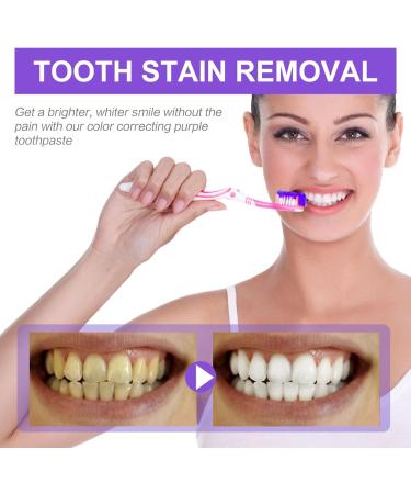 Purple Tooth Whitening: Violet Toothpaste for Stain Removal & Bright White Teeth (3PC) - Buy Online on GoSupps.com