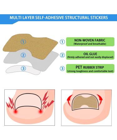 Moorovgi Ingrown Toenail Treatment Kit Ingrown Toenail Tool Kit Ingrown Toenail Removal Kit Ingrown Nail Removal Kit for Outgrow for Ingrown Toenails - Buy Online on GoSupps.com