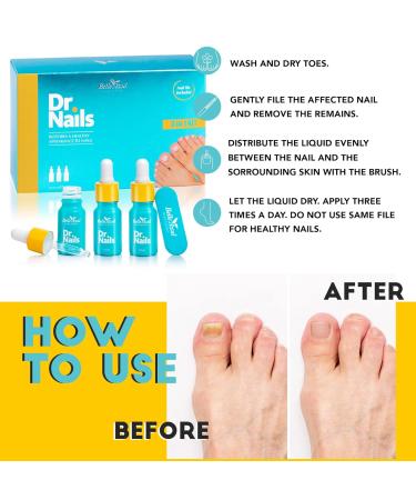 Belle Azul Dr. Nails Anti-Fungal Treatment | Nail Polish 3x10ml - Strengthen Nails with Organic Argan & Tea Tree Oil Vitamin E - Made in Spain - Buy Online on GoSupps.com