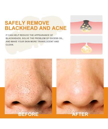 Blackhead Removal Nose Patches - Deep Cleansing Pore Strips for Instant Unclogging & Oil Removal (20 Patches - Buy Online on GoSupps.com