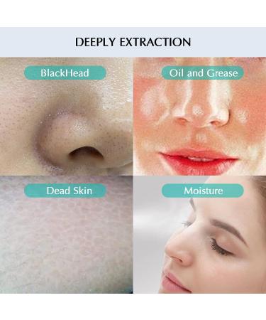NEWDERMO Microdermabrasion Machine with Nano Facial Mister - 5 Suction Power & 4 Heads, USB Rechargeable At-Home Dermabrasion Device for Men & Women - Buy Online on GoSupps.com