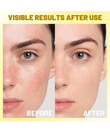 IREV Deep Vitamin C Capsule Face Moisturizer Moisturizing Facial Cream Transparent Gel for Radiant Skin Hydrating Night Face Skin Care Jelly Cream for Dull Uneven Tone 4.9 OZ - Buy Online on GoSupps.com