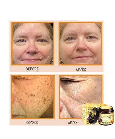 Hacaus Bee Venom Comprehensive Cream 2025 New Skincare Treatment Bee Venom Skin Cream Visibly reduces skin blemishes Natural Skin Moisturizer for Face and Body - Buy Online on GoSupps.com