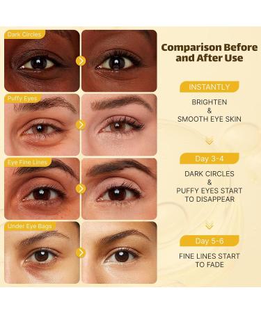 Under Eye Patches for Puffy Eyes & Dark Circles - 20 Pairs Gold Mask with Hyaluronic Acid & Collagen - Reduce Wrinkles & Relieve Pressure - Eye Care Treatment for Men & Women - Buy Online on GoSupps.com