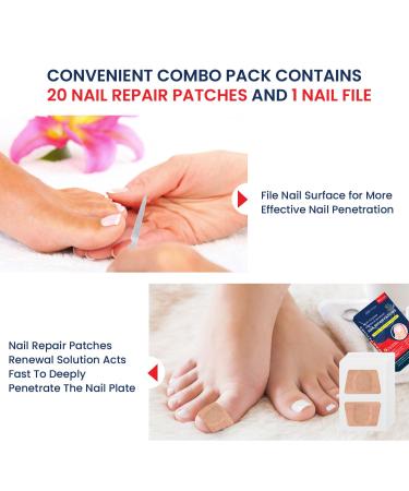Extra Strength Multi-Purpose Fungus Nail Patches | Effective Toenail & Ingrown Toenail Treatment | Nighttime Fungal Nail Solution - Buy Online on GoSupps.com