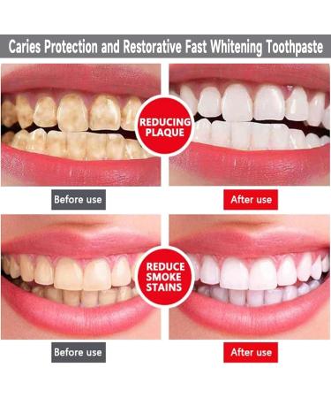 Renh Artisan Fluoride-Free Toothpaste: Probiotic Gum Protection & Fast Lightening (3-Pack) - Caries Protection & Restoration - Buy Online on GoSupps.com