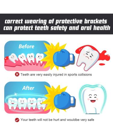 Vanmor Sports Mouth Guard  6 Pack Youth Mouthguard for Youth Adults Double Colored Gum Shield with Case for Football Basketball Boxing MMA Hockey  Moldable Kids Mouthpiece for Lacrosse Rugby Taekwondo - Buy Online on GoSupps.com
