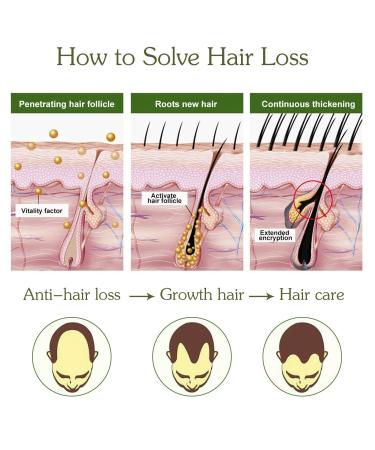 Hair Growth Serum for Men & Women - Anti-Hair Loss Accelerates Growth Fuller & Thicker Hair - Buy Online on GoSupps.com