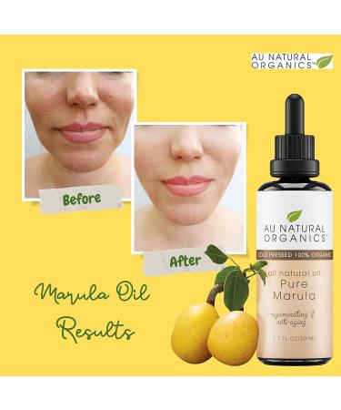100% Pure Marula Oil for Hair and Skin - Natural Moisturizer and Anti-Aging Treatment - Cold-Pressed Organic - 1.7 Oz - Buy Online on GoSupps.com