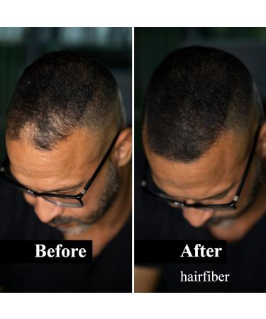 LEON MIGUEL Hair Fiber - Premium Hair Thickener for Balding and Thinning Hair, 25g (Black) - Buy Online on GoSupps.com