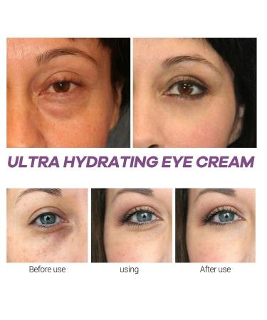 Xylane Eye Cream for Dark Circles & Puffiness | Anti-Aging Caffeine & Pro-Xilane Eye Repair | Lifting Anti-Wrinkle Formula - 15g - Buy Online on GoSupps.com