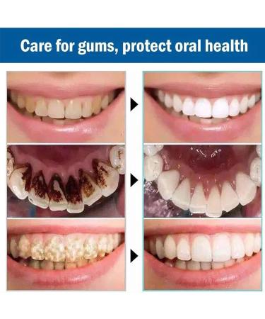 Fortbite Tooth Powder - Natural Whitening Toothpaste with Bentonite Clay for Stain Removal - 90ml - Fast Teeth Cleaning Solution - Buy Online on GoSupps.com