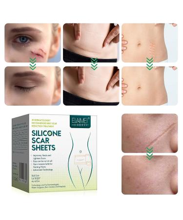 Silicone Scar Sheets Roll - Professional Scar Removal Tape for C-Section, Surgery, Burn, Acne - 1.6 x 120 Roll-3M - Buy Online on GoSupps.com