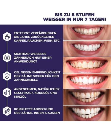 AriNoy Premium Whitening Strips - 40 Safe Teeth Whitening Strips for Effective Enamel Care | International Shipping Available - Buy Online on GoSupps.com