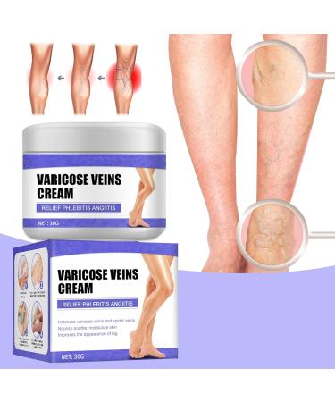 POWWA Varicose Veins Cream | Effective Vein Healing Treatment for Legs with Blue Light Therapy - Buy Online on GoSupps.com
