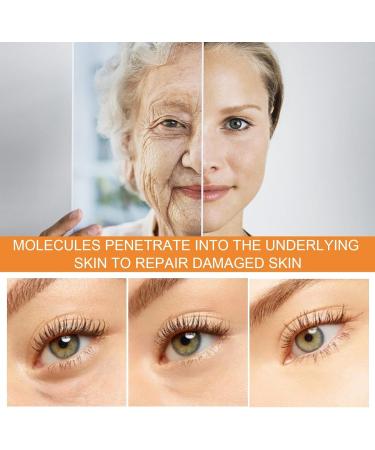 Vitamin C Serum Face Spray Hyaluronic Acid Hydrating Face Mist Brightening Serum Spray For Reduce Crow'S Feet Wrinkles & Neck Lines Vitamin C Face Toner Spray And Hydrolyzed Collagen Eye Mask - Buy Online on GoSupps.com