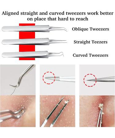 JCIW Blackhead Remover Tool Kit - Stainless Steel Professional Acne Extractor Set for Blackheads, Pimples, and Blemishes - Silver - Buy Online on GoSupps.com