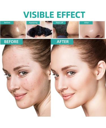 Buy Activated Charcoal Blackhead Remover Mask - Deep Cleansing Peel Off Face Mask with Pimple Extractor & Brush | 120g - Buy Online on GoSupps.com
