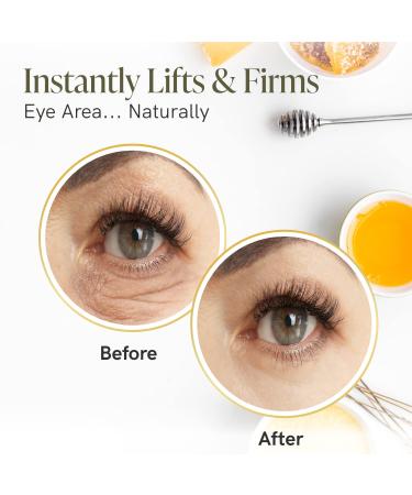 Bee Rx Anti-Aging Eye Lift Roller with Kanuka Honey - Instant Firming Eye Cream for Wrinkles and Fine Lines - Buy Online on GoSupps.com