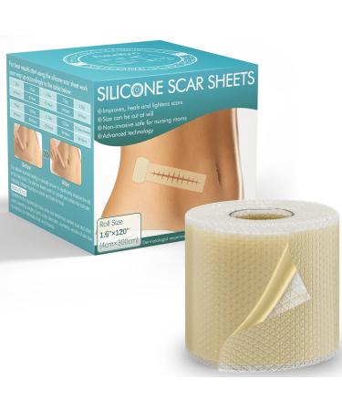 Silicone Scar Sheets(1.6 x 120 Roll-3M) Easy-Tear Silicone Scar Tape Works on Old & New Scars Professional & Effective Scar Silicone Strips For Scars Caused By C- Section Surgery Burn Keloid et 1.6in*120in