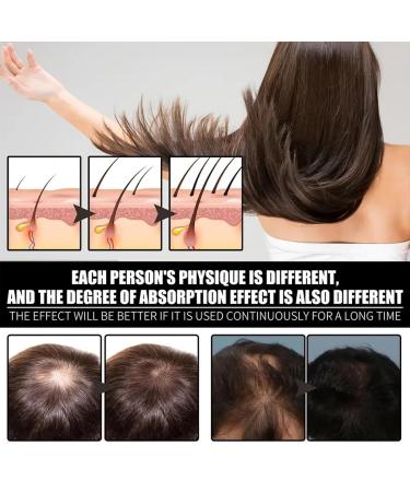 100% Cold Pressed Rosehip Seed Oil - Organic Moisturizer for Face & Skin | Anti-Aging Fine Lines & Wrinkles Reduction | Perfect for Women s Massage Hair & Body - Buy Online on GoSupps.com