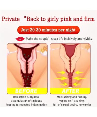 AnnieCare 2023 Instant Anti-Itch Detox Slimming Capsules - Firming & Repair | Natural Vaginal Health - 3Pcs - Buy Online on GoSupps.com