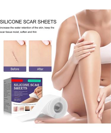 Silicone Scar Removal Tape Roll for Hypertrophic Scars - Post Surgery, Acne, Burns - Caesarean Section Safe - Buy Online on GoSupps.com