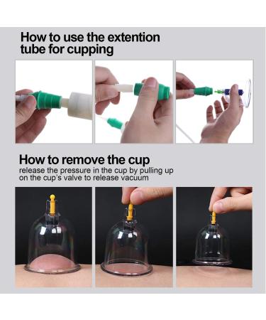 AIKOTOO 32 Cups Cupping Set with Pump | Hijama Cupping Therapy Kit for Acupoint Massage | Professional Chinese Vacuum Suction Cups for Pain Relief and Cellulite Massage - Buy Online on GoSupps.com