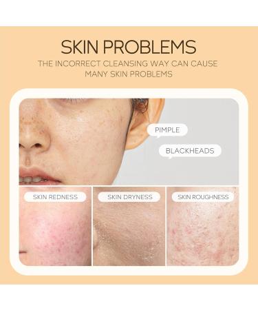 Vitamin C Hydrating Foaming Facial Cleanser - Gentle Acne-Prone Skin Wash with Silicone Brush - Vegan Daily Cleanser for Men & Women - 4.2oz - Buy Online on GoSupps.com