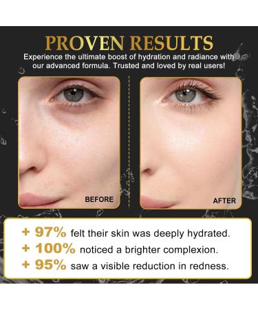 Uocasi Snail Mucin Sheet Mask 6EAHydrogel Collagen Mask for Face Masks Skin CareSelf CareDeep MoisturizingBoost Collagen for ElastinGifts for WomenFace Masks Dry Skin - Buy Online on GoSupps.com