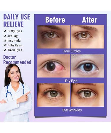 Serfeymi 16-Pack Self-Heating Steam Eye Masks for Sleeping - Lavender & Chamomile | Disposable Eye SPA Mask for Mother's Day Gifts - Buy Online on GoSupps.com