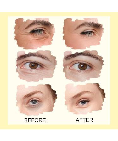 Snail Essence under Eye Cream - Ball Design Eye Bags Remover - Eye Cream for Dark Circles and Puffy Eyes - Anti Aging Eye Cream Tightening Lifting Sagging Skin - Repairing Skin - Buy Online on GoSupps.com