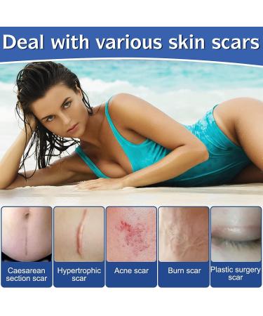 Silicone Scar Sheets (1.6 x 120 Roll) - Medical Grade Scar Tape for Acne, C-Section & Keloid Scars - Buy Online on GoSupps.com
