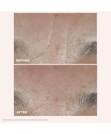 Clarins NEW Total Eye Lift | Anti Aging Eye Cream | Targets Wrinkles Crow's Feet Dark Circles and Puffiness For a Visible Eye Lift in 30 Seconds | REFILLABLE Total Eye Lift 0.5 Oz - Buy Online on GoSupps.com