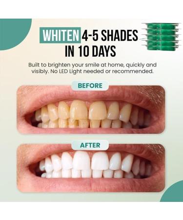 Teeth Whitening Trays Prefilled Whitening Kit Professional Tooth Cleaning Trays with Refreshing Mint Flavor for Men Women Easy At Brightening Solution for Health & Hygiene - Buy Online on GoSupps.com