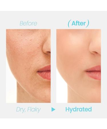 Hydration Barrier 96+ Serum | Hydrating K-Beauty Serum with Beta-Glucan Panthenol & Ceramides for All Skin Types | Skin Barrier Repair Moisturizer (50ml - Buy Online on GoSupps.com