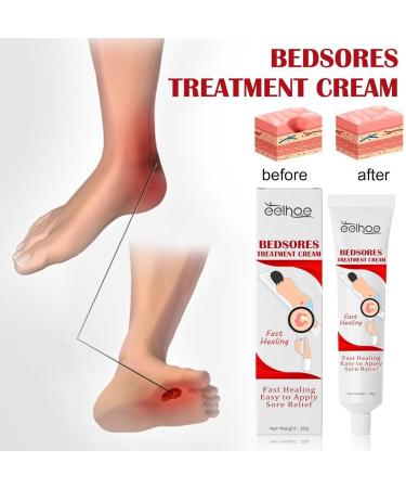 5 Bedsore Cream Bed So re Cream Fast Acting Pressure Sor e Relief Cream Bedsore Wound Care Cream Fast Wound Healing Gel Soothing Relief Of Bed Soress 20g Bedsore Ointment Bed Soress Care Crea - Buy Online on GoSupps.com