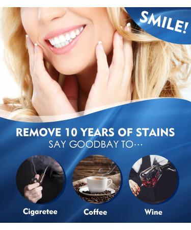 Anpatio Teeth Whitening Strips - 42 Non-Slip Treatments for Safe, Enamel-Friendly Whitening - Includes Mouth Opener - Non-Sensitive Formula - Buy Online on GoSupps.com
