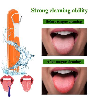 Stainless Steel Tongue Scraper Set - 4 Pack Reusable Metal Tongue Cleaners for Fresh Breath | Portable Oral Care with Travel Case (4 Colors - Buy Online on GoSupps.com