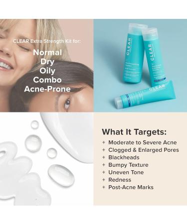 Paula's Choice CLEAR 3-Piece Acne Kit Includes Daily Cleanser 2% Salicylic Acid Exfoliant & Benzoyl Peroxide Treatment Prevents & Treats Mild to Severe Acne & Breakouts Fragrance-Free Set of 3 Full Size - Extra Strength - Buy Online on GoSupps.com