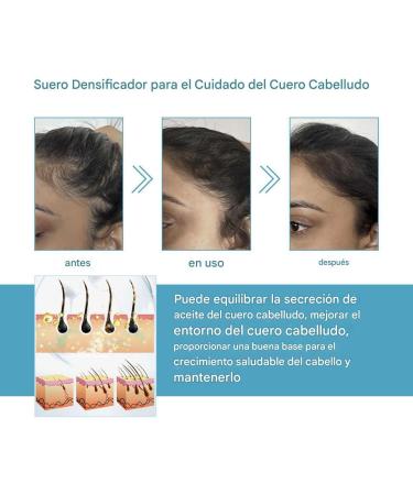 For curly hair 30 ml drops for scalp and density | For hair growth to moisturize prevent breakage loss and thinning promotes thickness for women - Buy Online on GoSupps.com