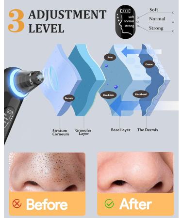 Black Head Remover Tools Blackhead Pore Vacuum: Electric Facial Pore Cleaner 3 Suction Levels Rechargeable Pimple Comedone Extractor Skin Care for Face - Buy Online on GoSupps.com