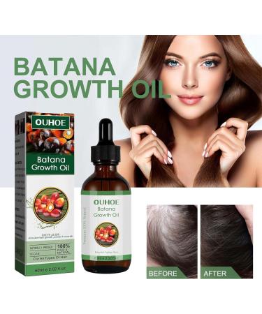 BAInuai Batana oil for hair growth100 organic Batana Oil Organic for Growth Hair promotes hair wellbeing in men and women improves the appearance of hair and skin 3 pieces - Buy Online on GoSupps.com