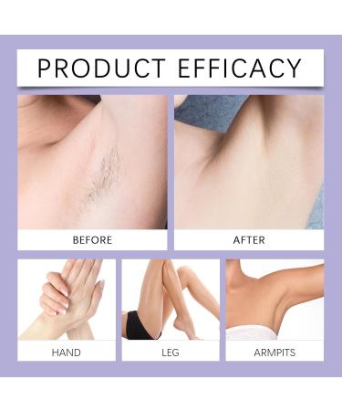 Cr me D pilatoire Ultra-douce For Le Corps - R sultats Lisses En 5 Minutes PH quilibr Formule Hydratante Et Nourrissante For La Peau(2PCS) - Buy Online on GoSupps.com