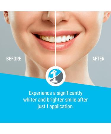 20X Mint Medium Tooth Polish & Stain Remover Cups - Achieve a Bright Smile | International Shipping Available - Buy Online on GoSupps.com